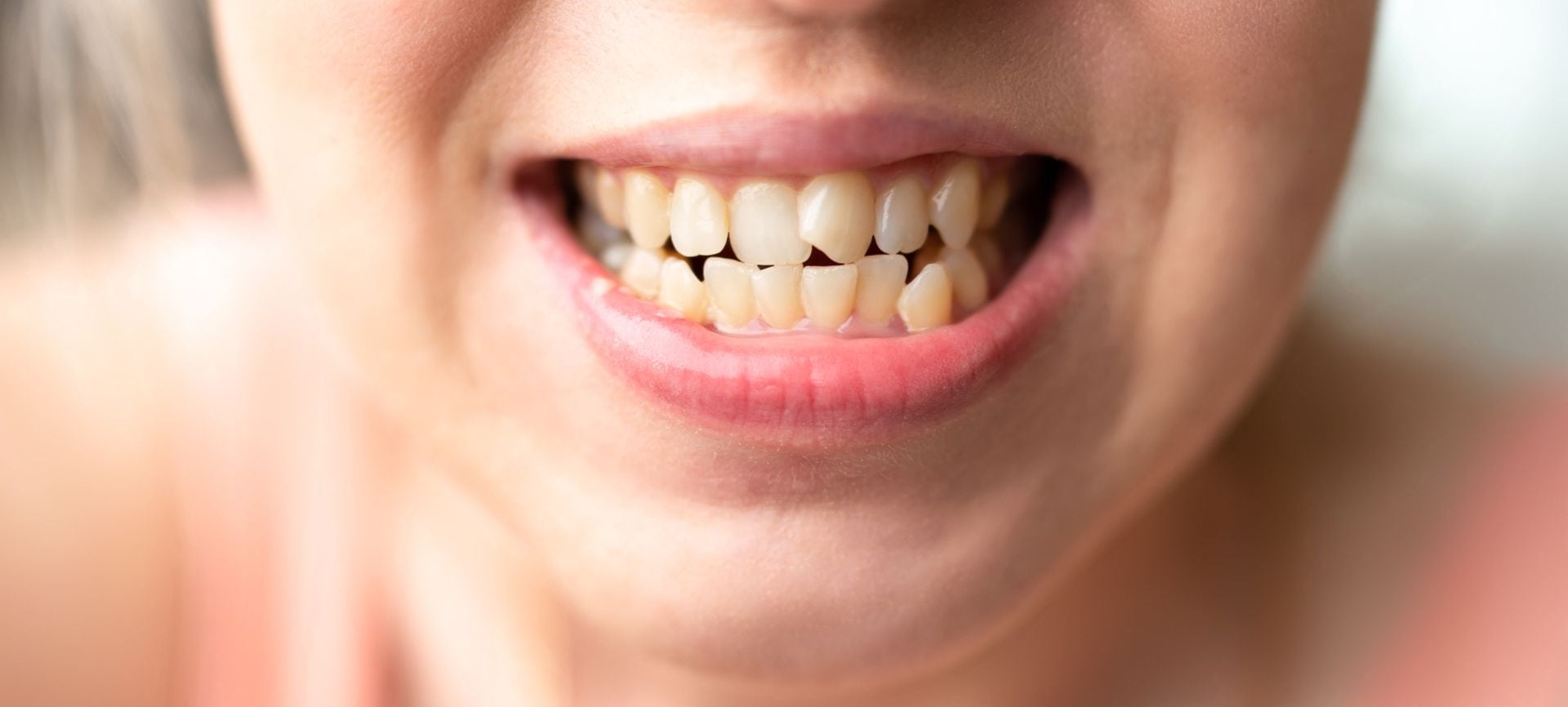 treating common orthodontic problems