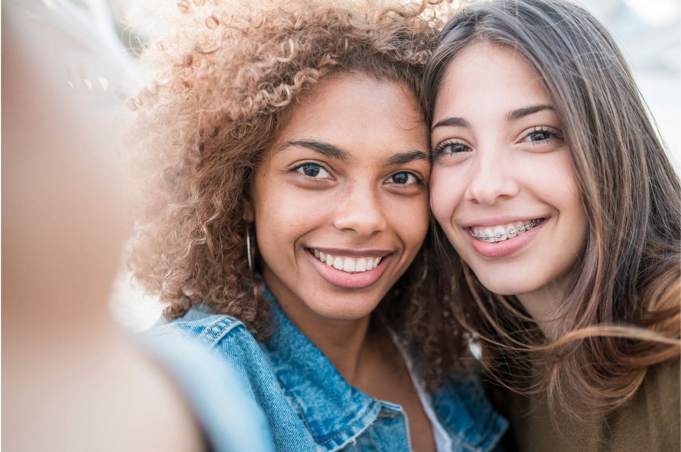 Cosmetic Dentistry Options That Can Transform Your Smile